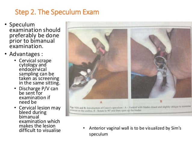 vaginal exam speculum Nude low rider
